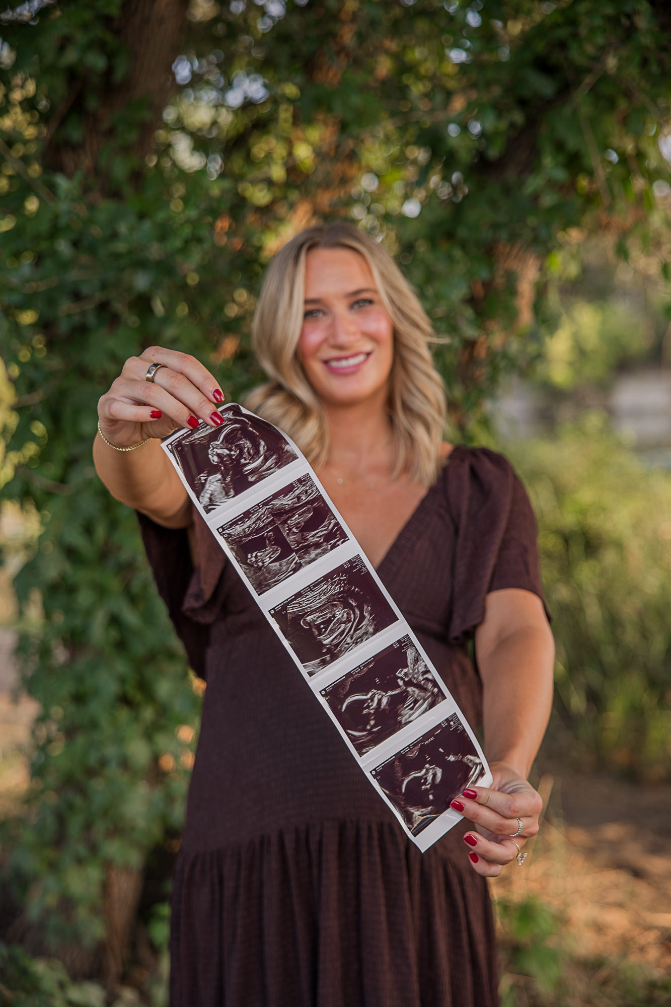 ultrasound picture maternity